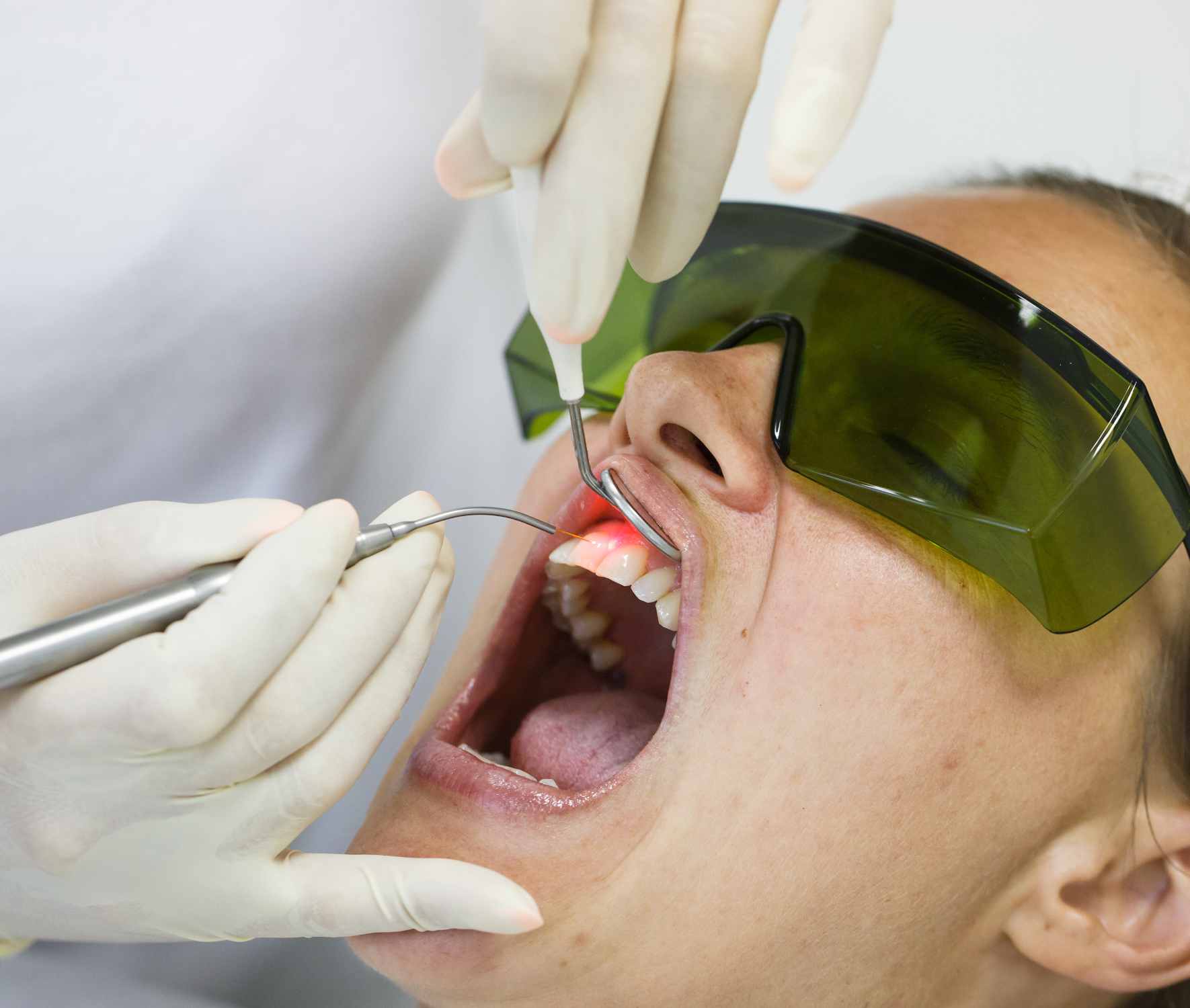 Laser therapy dental treatment