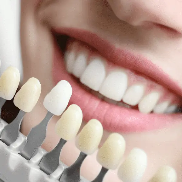 Client choosing teeth whitening at All About Smiles in Taupo