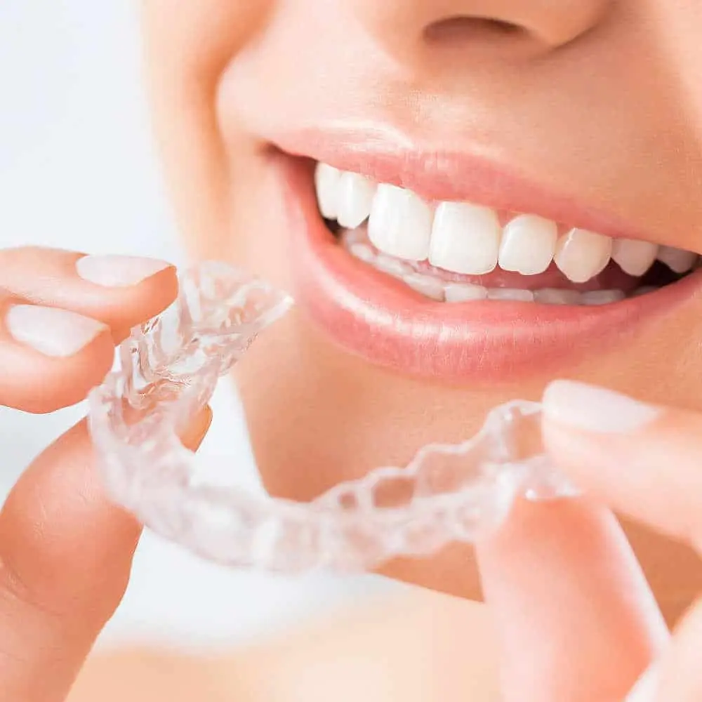 Woman holding clear whitening trays ready to fit over her teeth